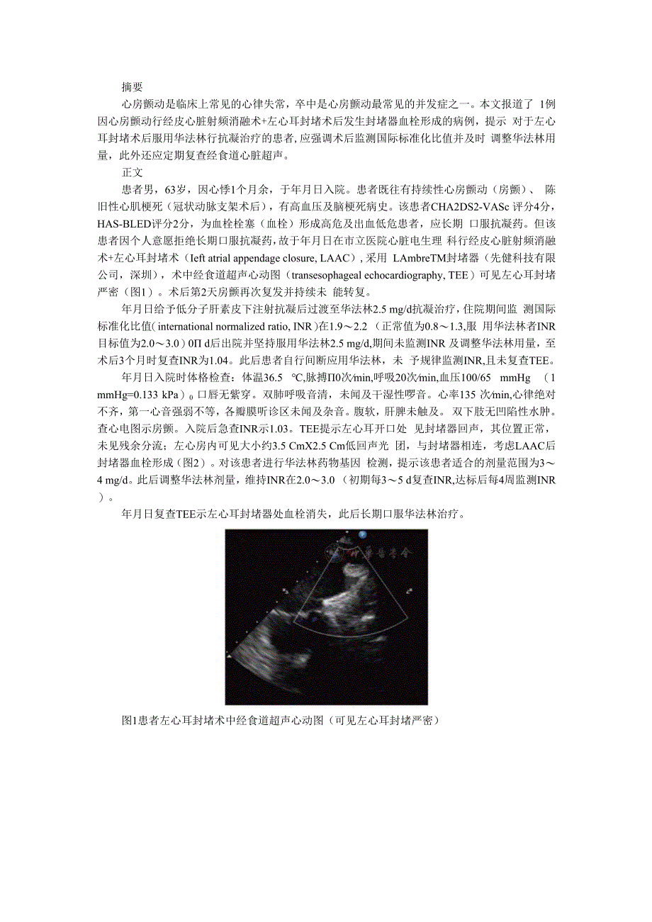 （病例报告）左心耳封堵器血栓两例.docx_第1页